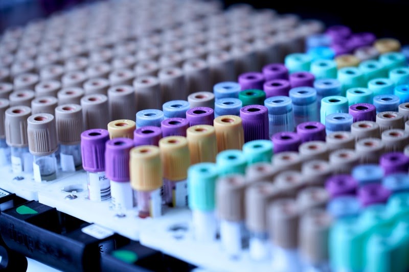 Beverage testing plays an integral part in the production process
